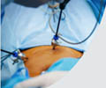 Gastroenterology